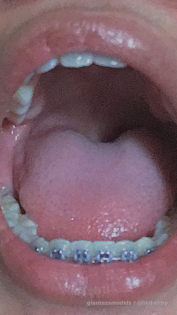 Free thai girl
Uvula
