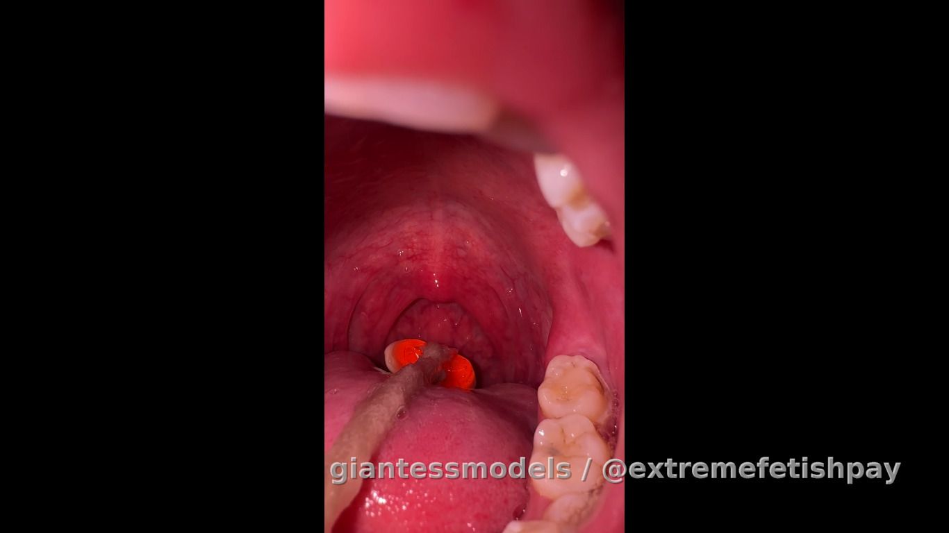 swallow and return gummy with cord 2