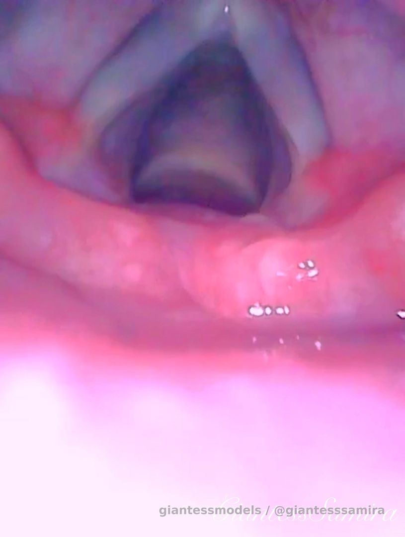 Epiglottis Fabulous close up view. You will love this video and it will make you run a lot 💦😈😈😈