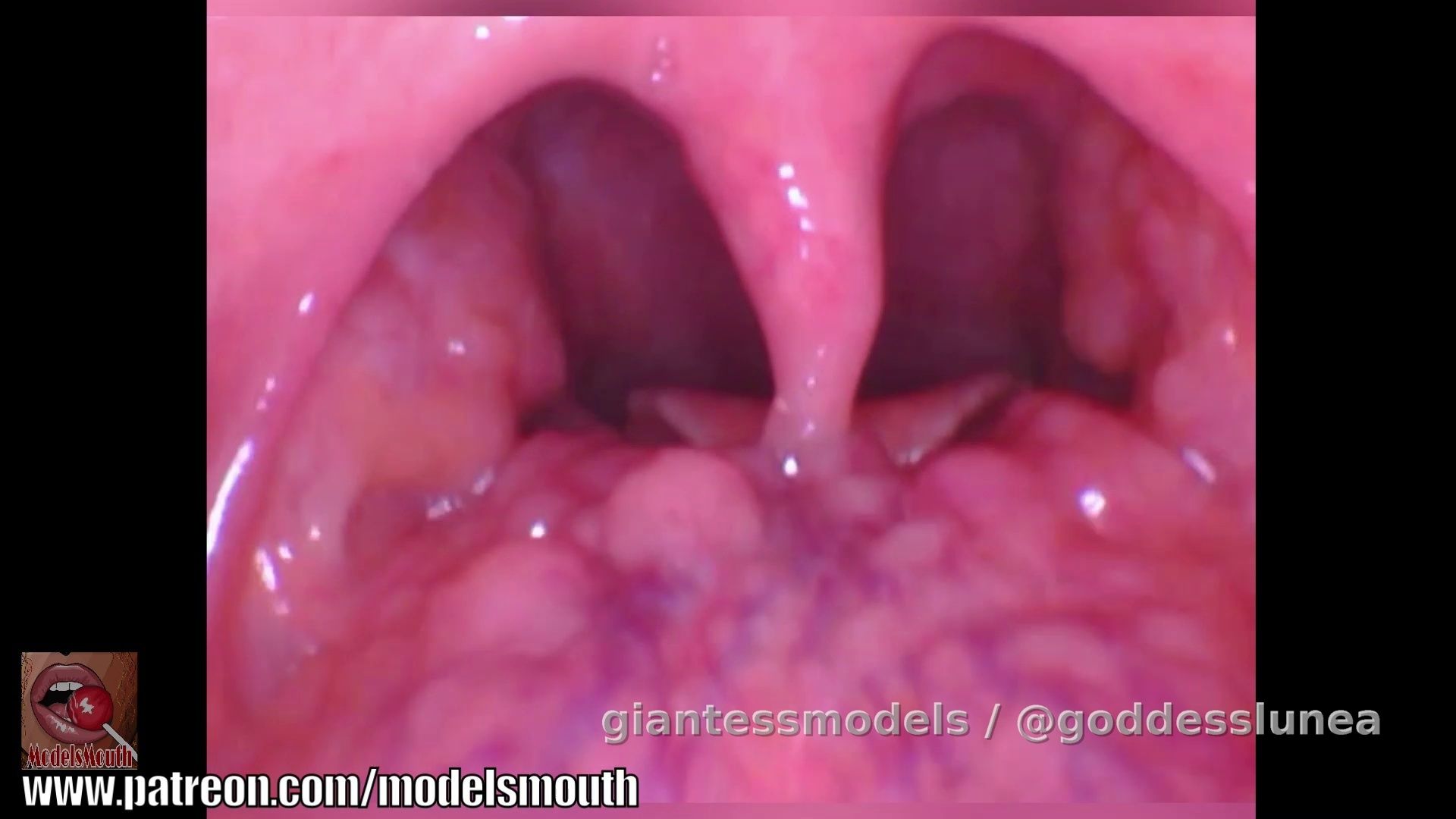 Vocal tour with endoscope