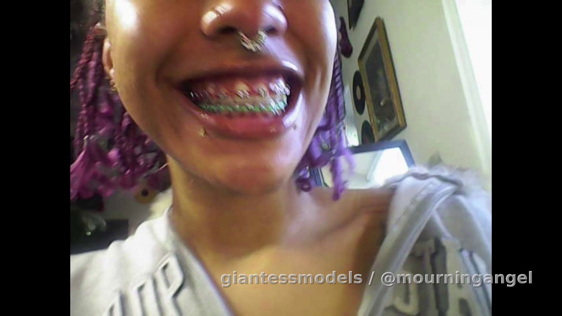 Mouth tour (endo only)