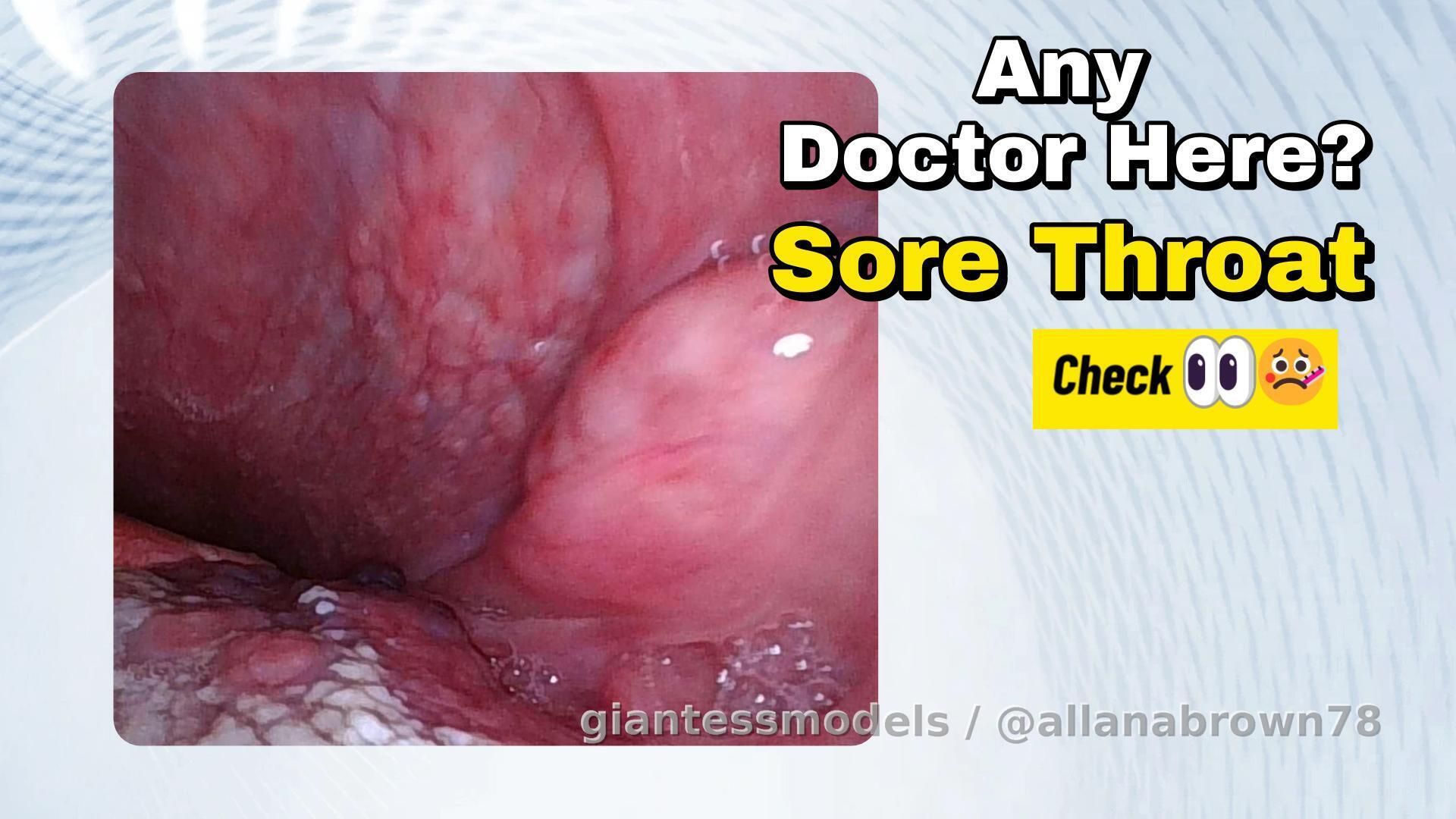 Any Doctor Here? Sore Throat Check 👀🤒 (ENDOSCOPE)

Not feeling great, so I took a closer look…
Does this look like a sore throat? My tongue looks white… and my tonsils seem off.
Dry cough and mocus too… what do you think this is? 😜😏