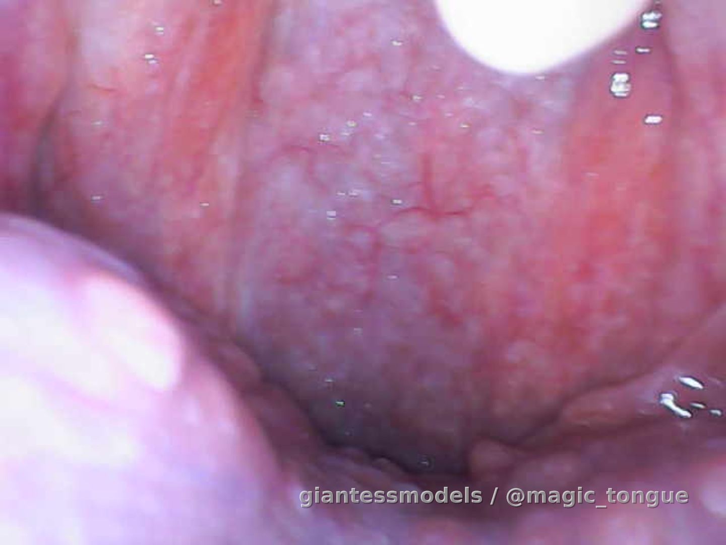 Endoscopic pics😈
