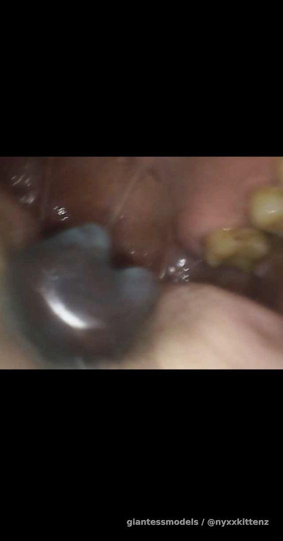 Watch gummies being swallowed whole with my endoscope! 