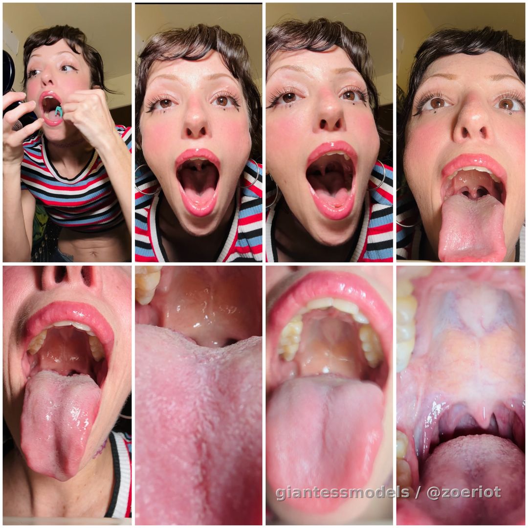 Zoe’s Got Something Stuck In Her Teeth…can you help? 