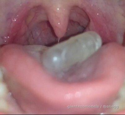 ANT VORE, swallowed and digested alive in a capsule.

Check my Profile for more.