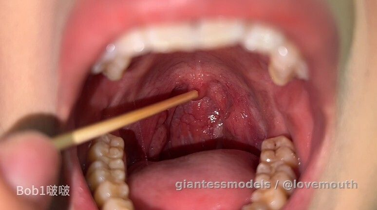 Girl playing with uvula