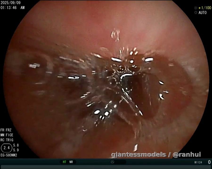 Rat endoscope