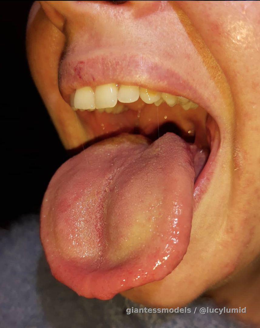 My tongue & uvula