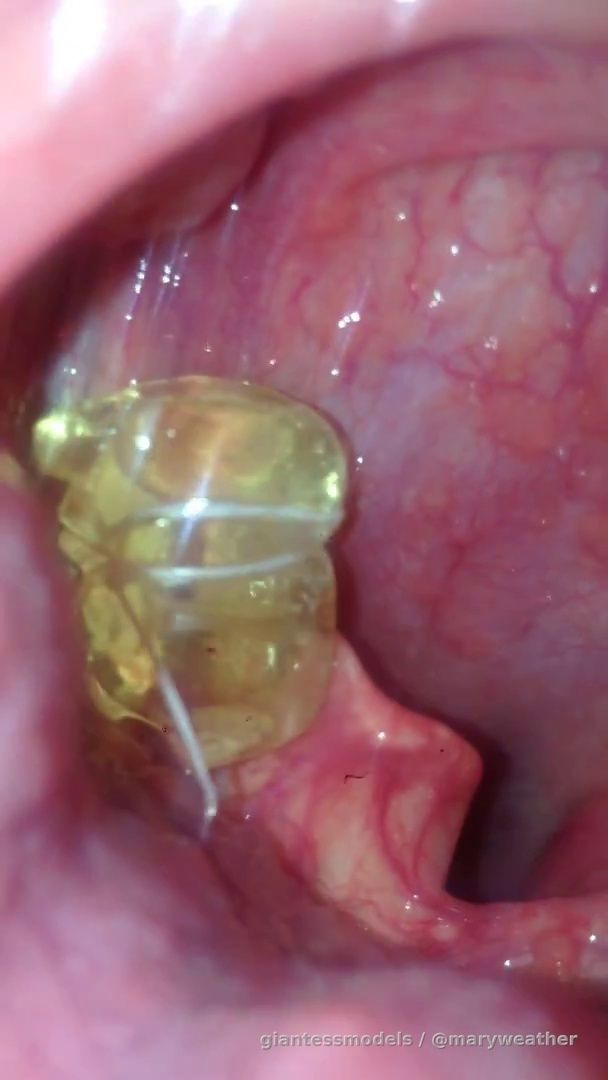 Swallowing a gummy bear family part 1