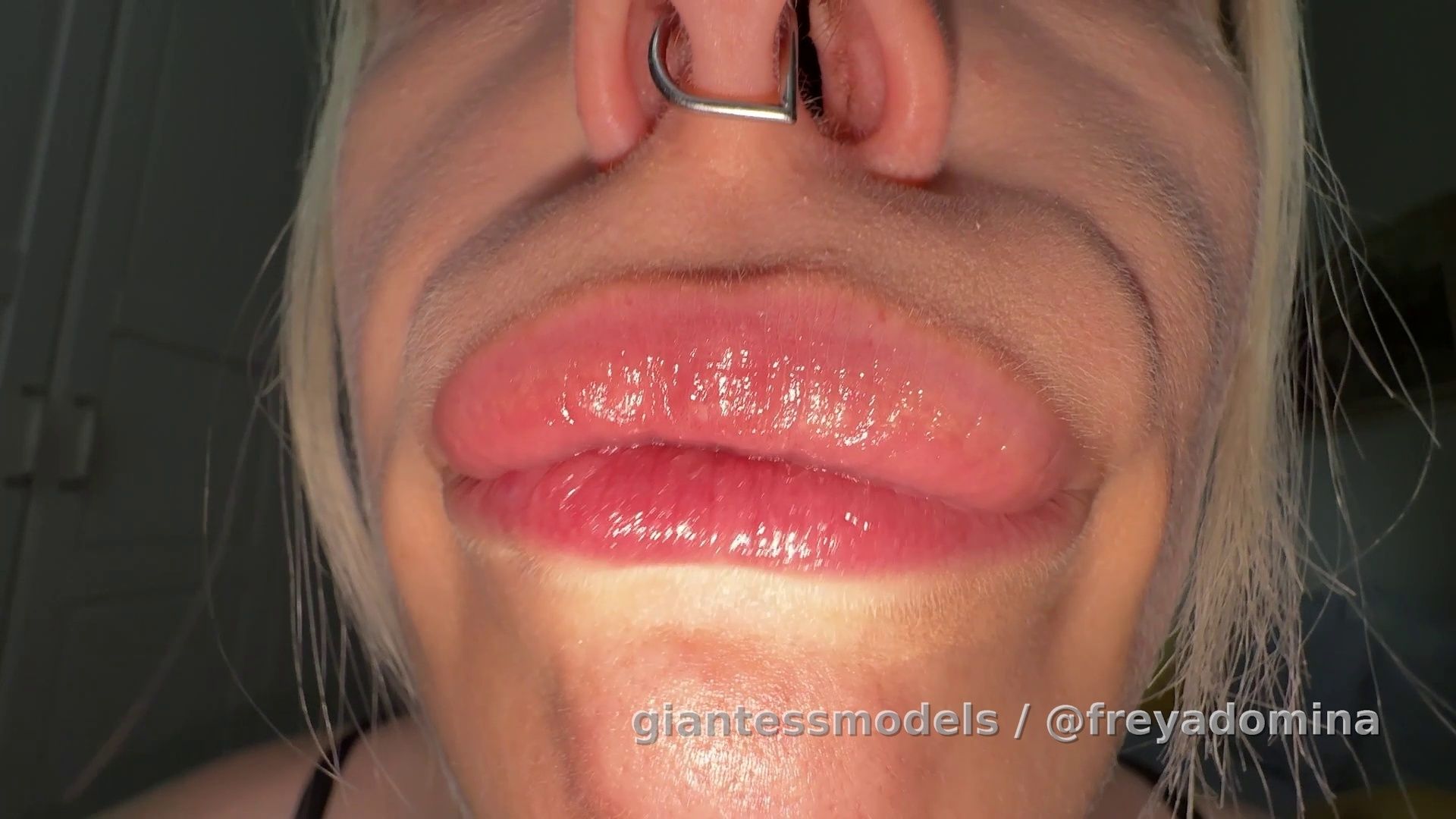 Gummy Bears Swallowed Endoscope