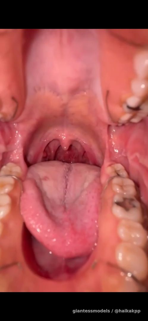 Thai girl show her uvula and play with finger