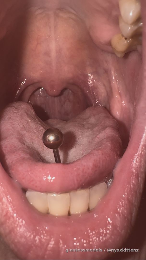 🎶 Watch my beautiful throat as I make ahhh noises🎶