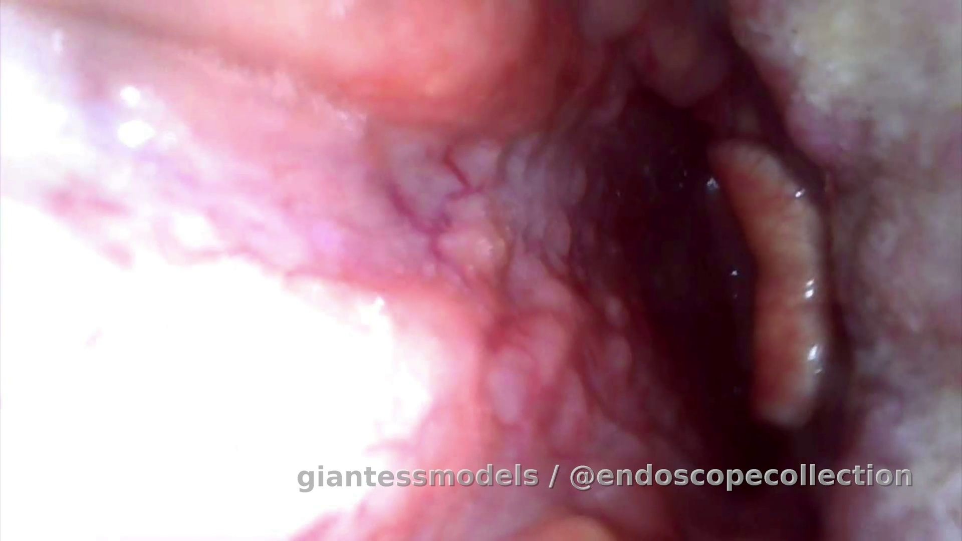 Giantess uses endoscope to show vocals