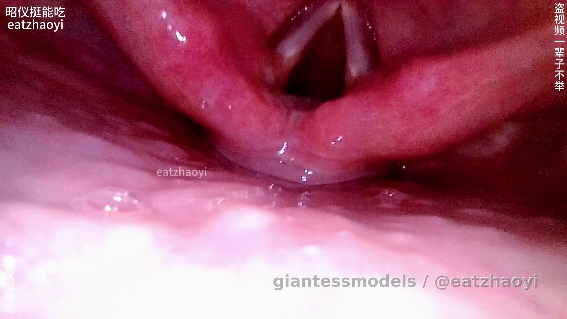 Endoscope reveals epiglottis and vocal cords, with persistent coughing, clear and obvious