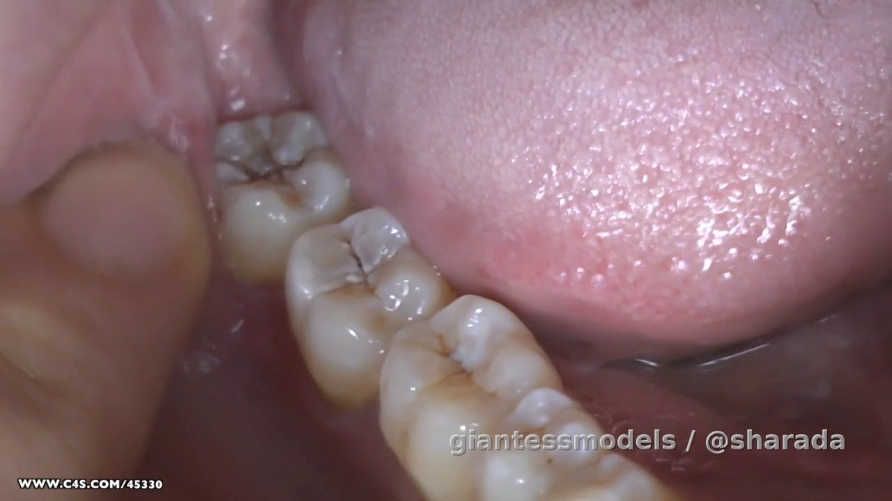Feel my teeth