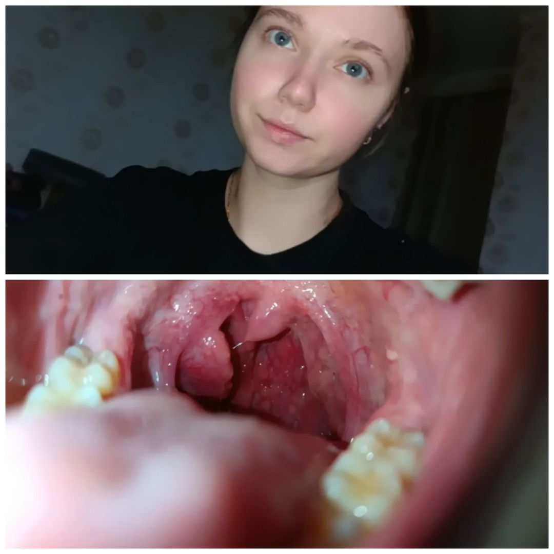 Throat (video 1 min)