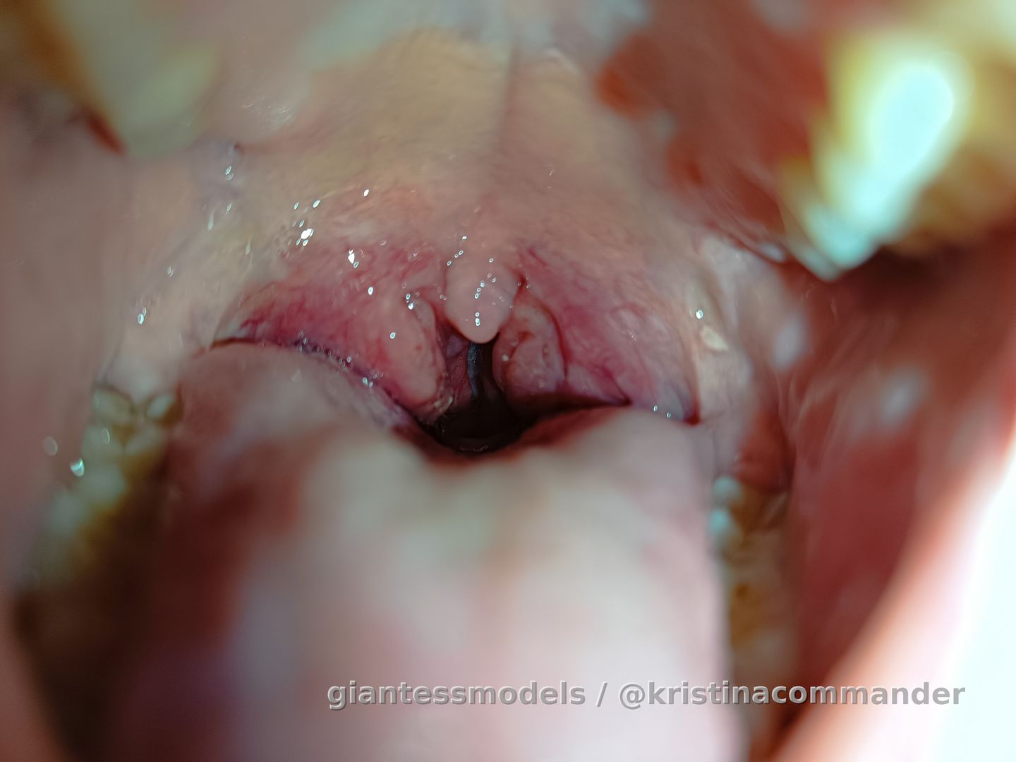 Close up throat (video 1 min)