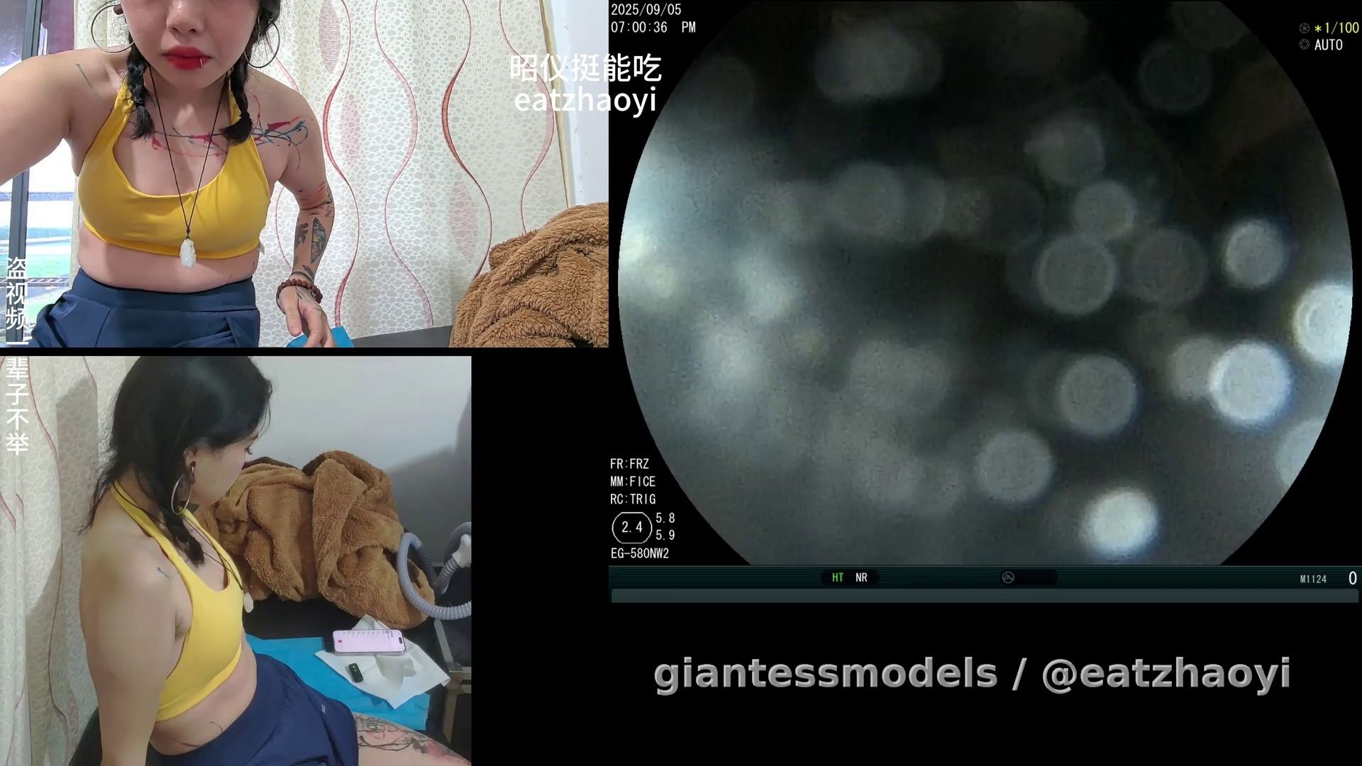 9 月14日 High quality Endoscope with doctor