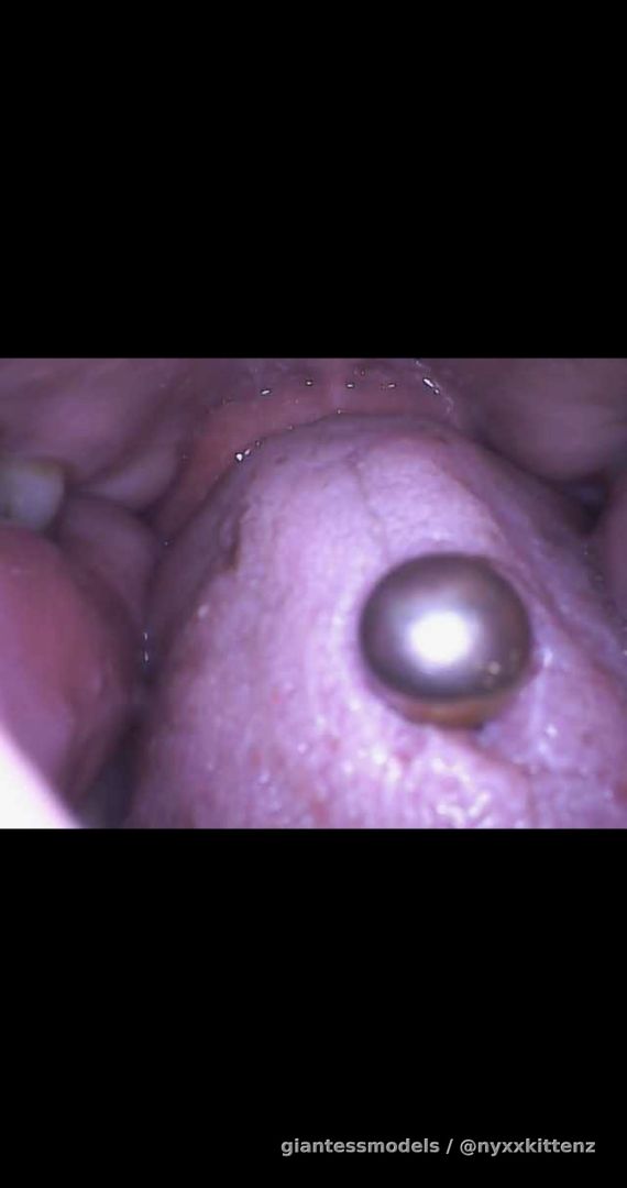 *endoscope* fun little video showing different views of my mouth and throat✨✨
