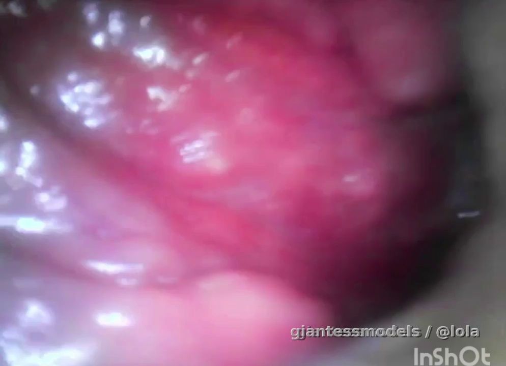 Smoker mouth tour and deep throat with endoscope 🥵