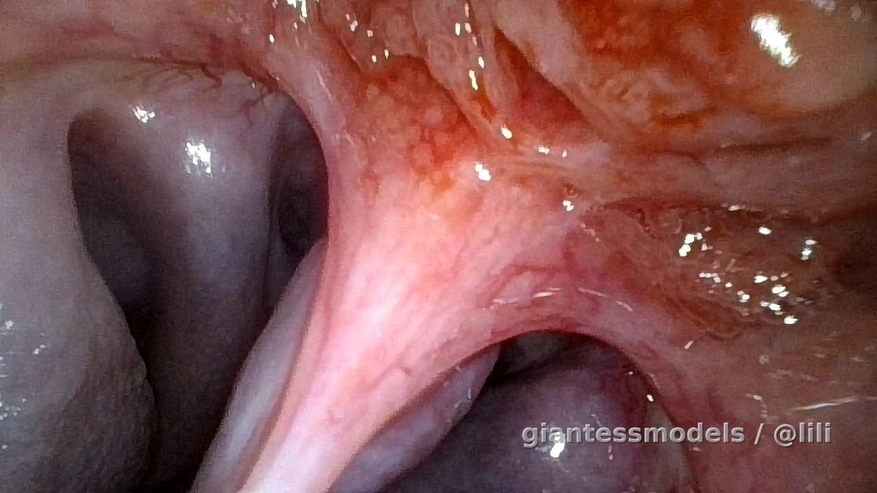 Empty stomach endoscope