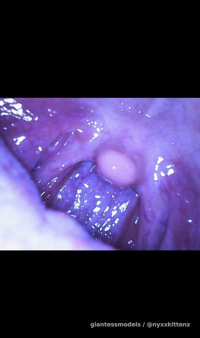 🤮Good throat and epiglottis shot and then BAM comes the throw up lol