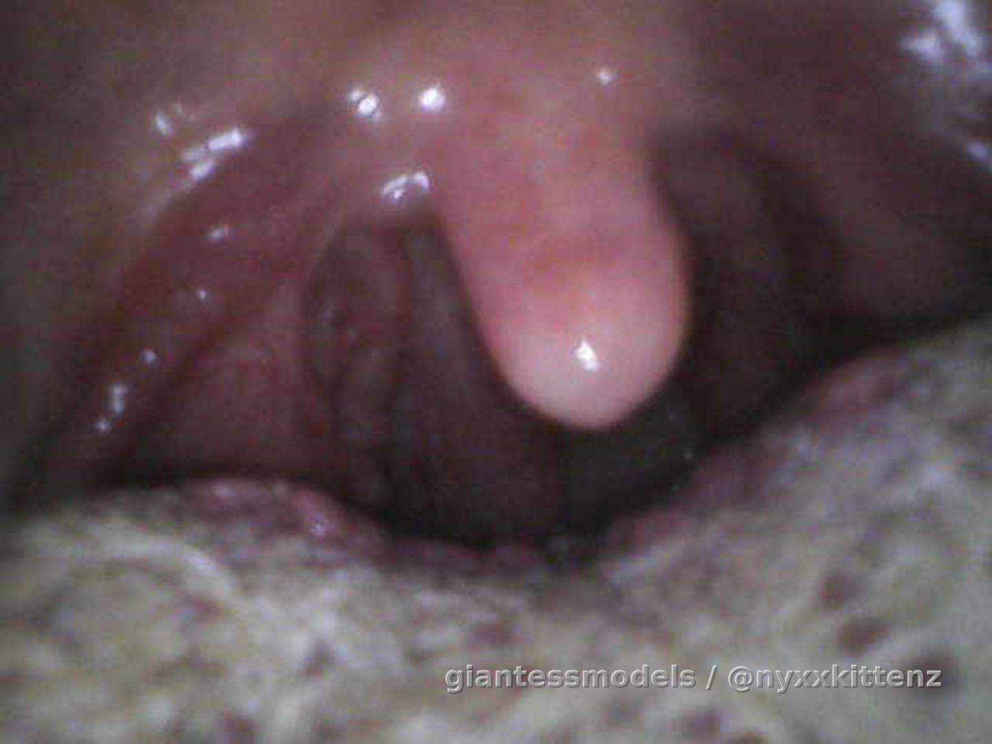 Sore throat Uvula dance ✨✨✨