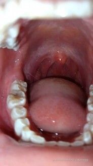 Fish Vore by unknown girl