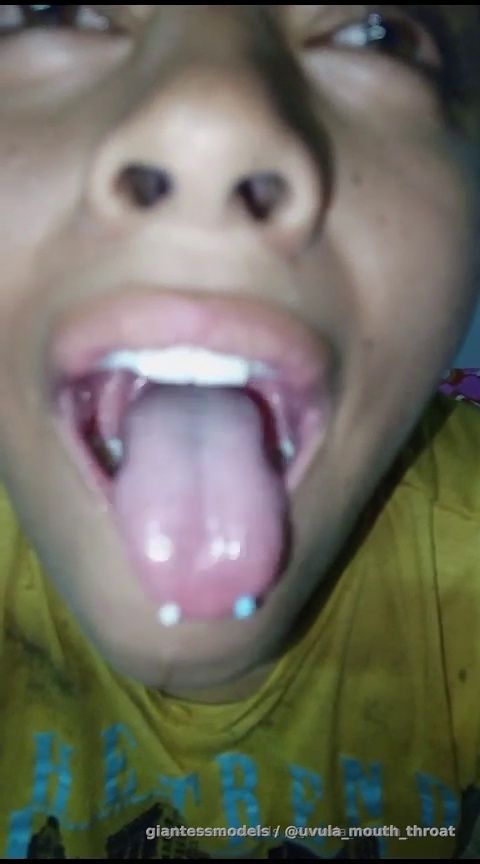 Colombian girl with big tonsils