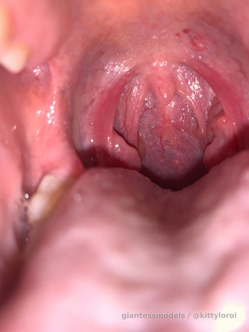 My throat hurts so bad 🥺