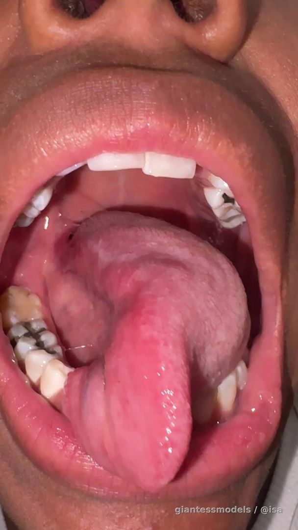 Tonsils