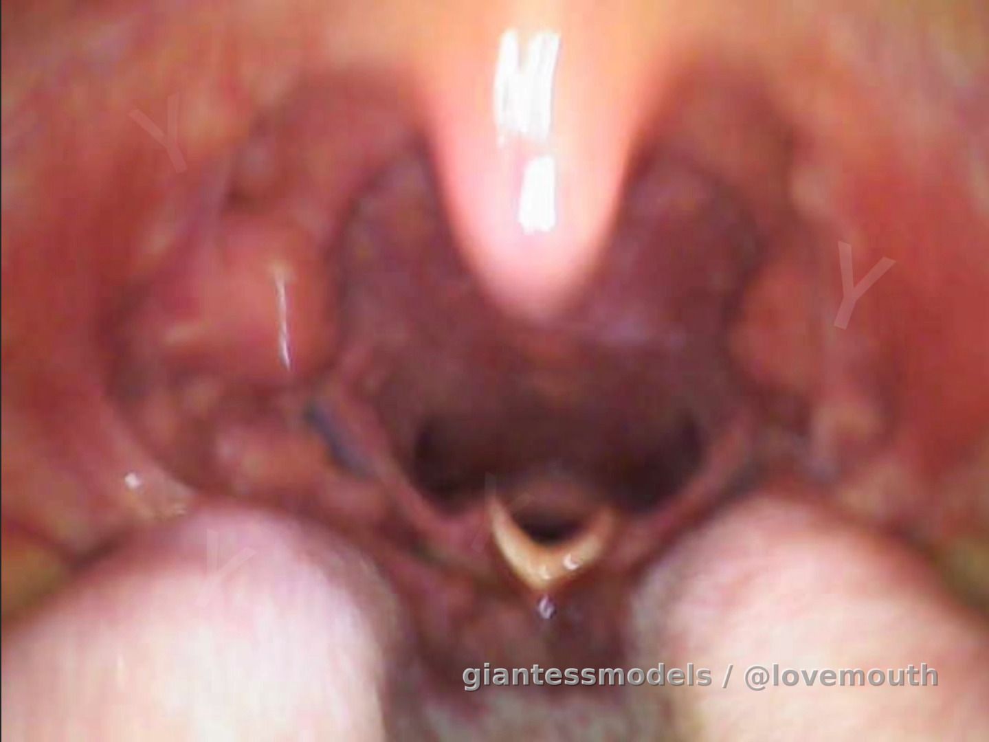 The Girl's Throat and the Endoscope