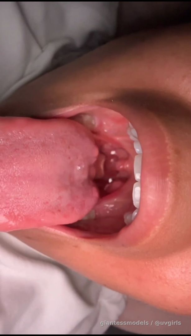 Latina girl with braces shows her uvula and epiglottis
