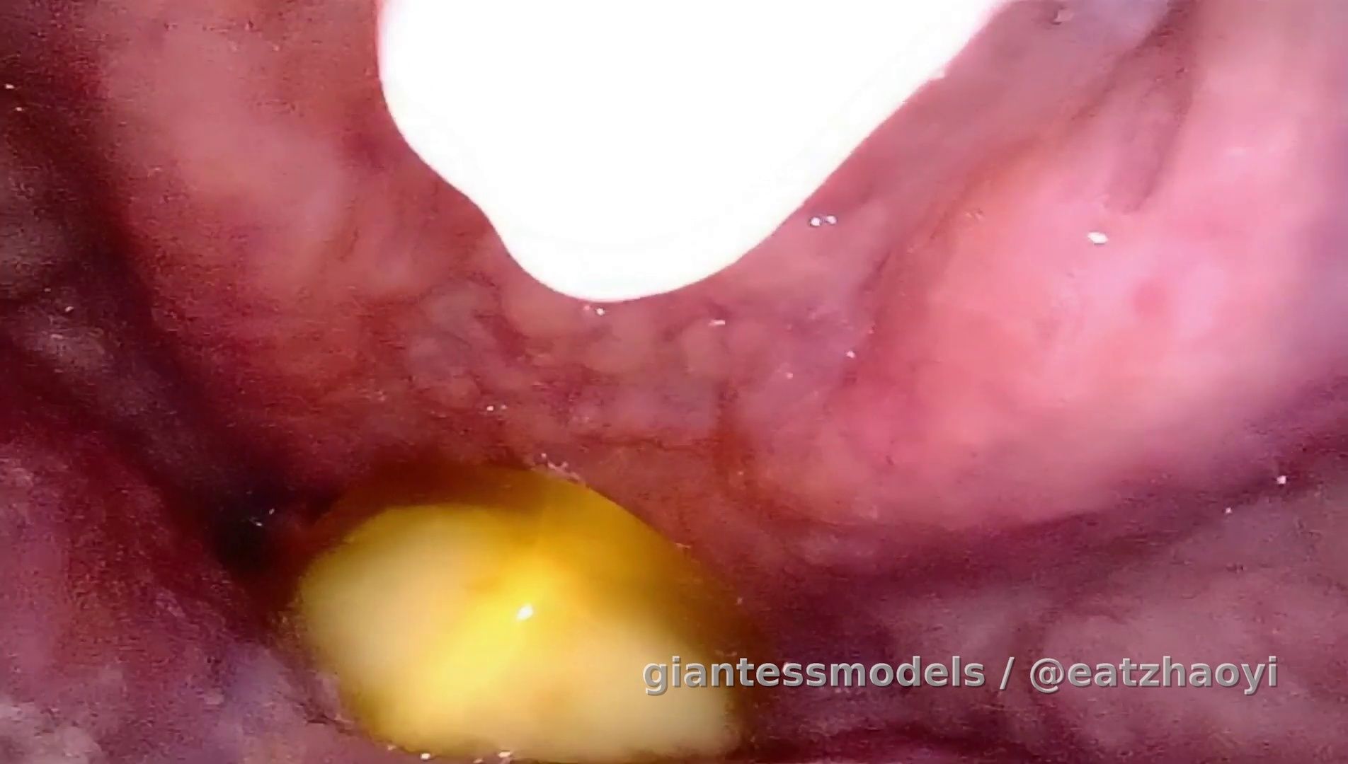 2025_5_6内窥口腔+内窥吞软糖+软糖抵在会厌+近距离小舌头+声带+呼吸咳嗽吞咽声_10分钟