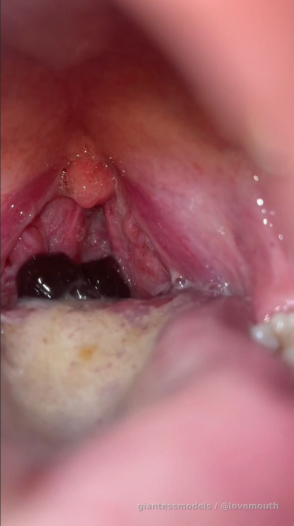 Girl swallows pearls