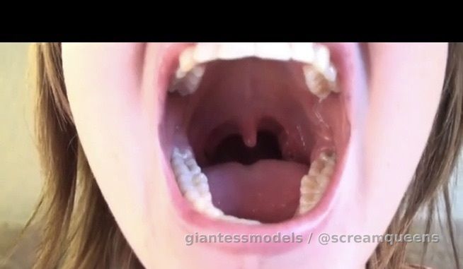 Widee Mouth Crazyy Huge Uvula Viewz