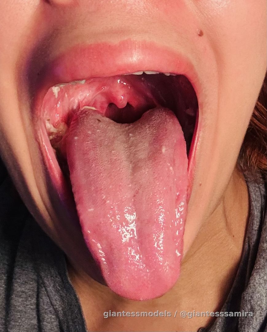 Uvula 