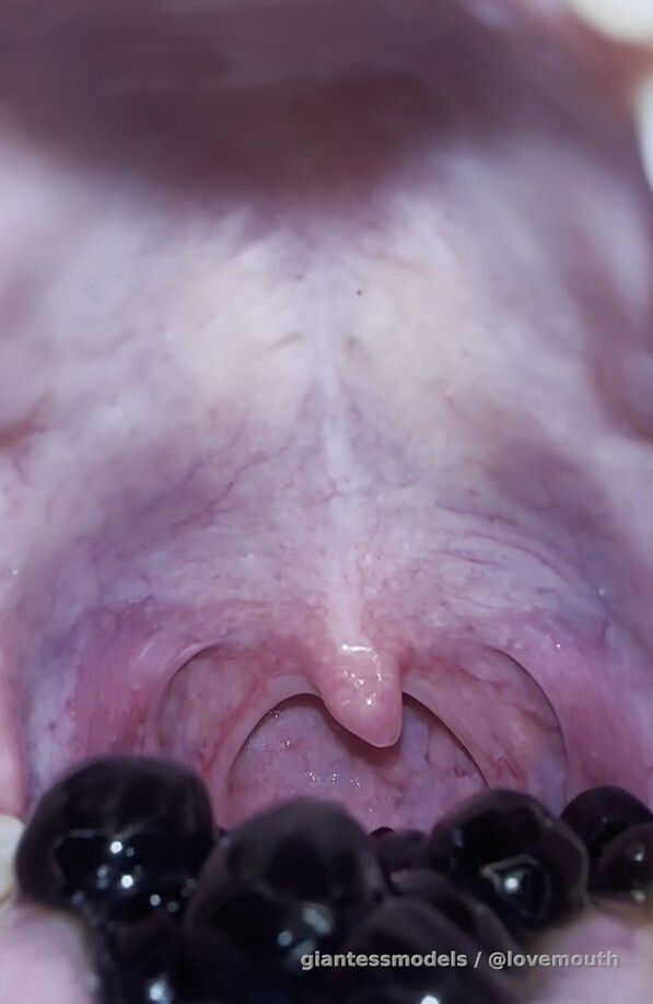 The girl swallowed many pearls, and finally spat them out by pressing her fingers against her tonsils.