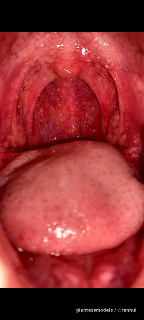 Big throat