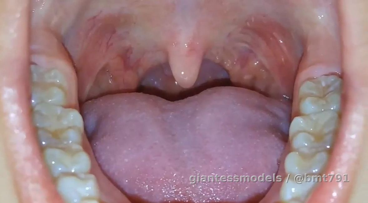 Sara's close up uvula view