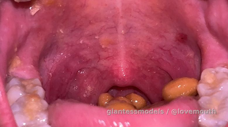 The girl swallowed a bean and showed her mouth.