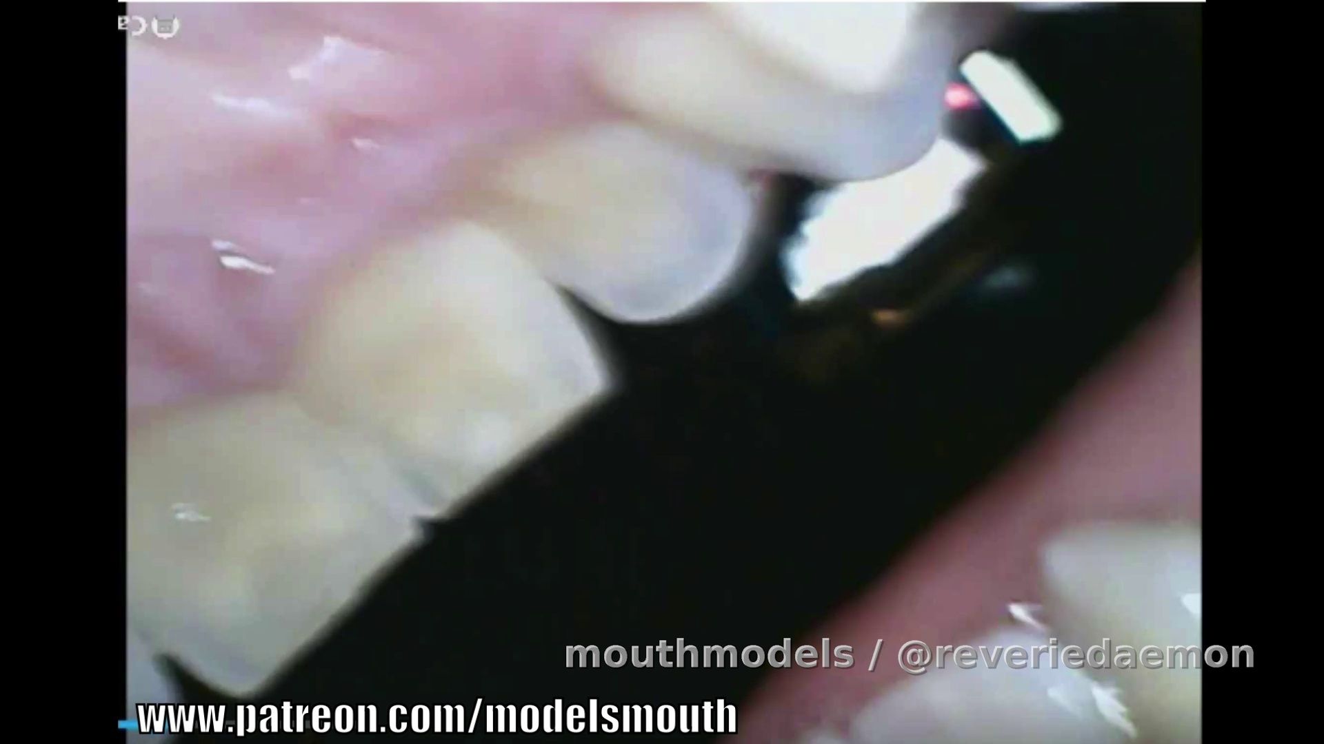 Endoscope Reverse tour