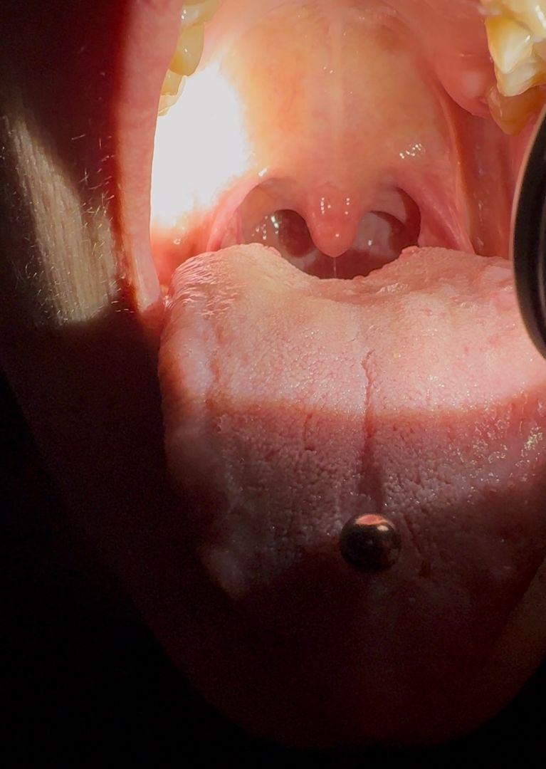 🔦Flashlight view of my throat as it contracts 