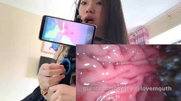 The girl used an endoscope to observe her digestion after a meal.