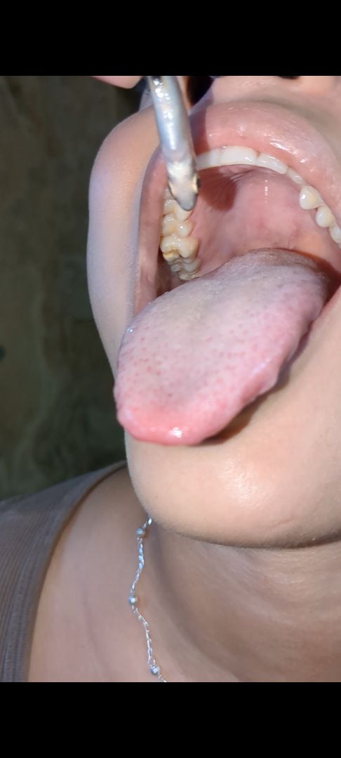 New girl swallow bala shark