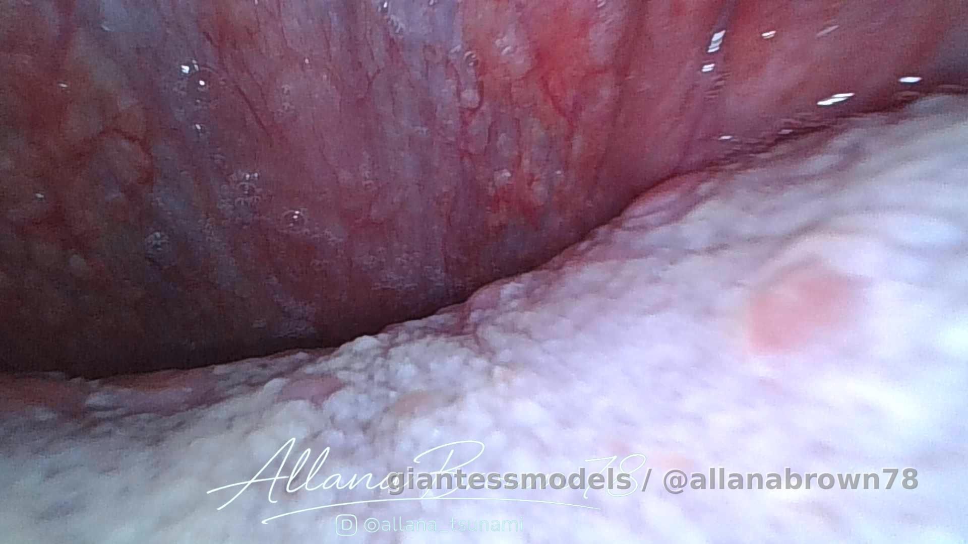 Internal View: Endoscopy Footage (No Sound)🤫

The camera glides through the mouth into the depths of the throat, revealing a hidden passage in quiet detail. Every movement captures the delicate textures and structures of this inner pathway. In silence, the journey offers a rare and intimate view.🏸