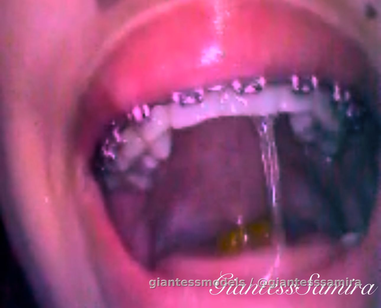 Gummy bears Vore. Uvula, dental, saliva, tongue, drooling, spitting, 