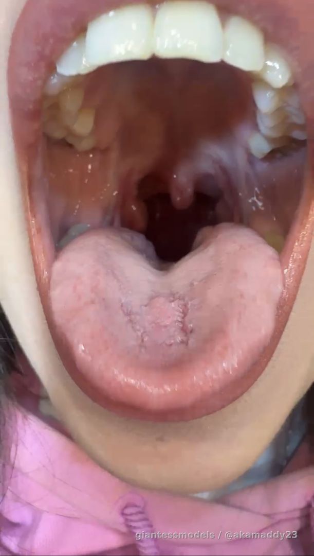 Maddy shows you the inside of her mouth up close