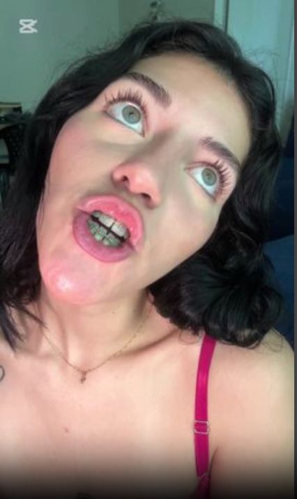 Talking, Swallowing Gummy Bears